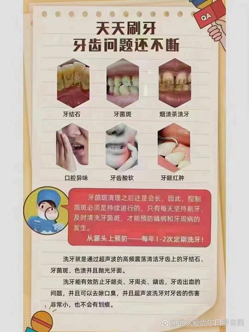 牙齿矫正期间,需要洗牙吗?-图1 牙齿矫正期间,需要洗牙吗?-图1