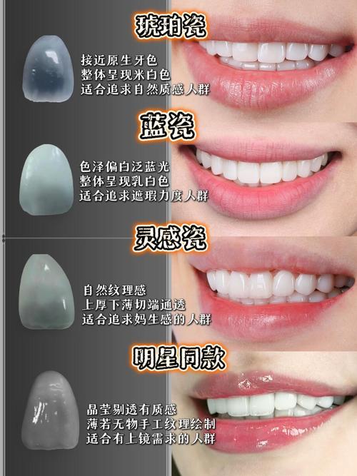 矫正牙齿改变命运-图3 矫正牙齿改变命运-图3