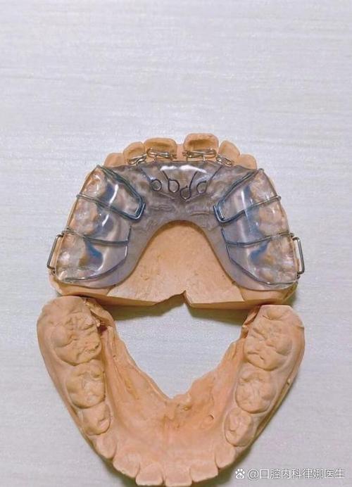 苏州成人牙齿矫正效果如何?要多久见效?-图3 苏州成人牙齿矫正效果如何?要多久见效?-图3