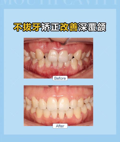 佳木斯矫正牙齿多少钱?效果和医院怎么选?-图1 佳木斯矫正牙齿多少钱?效果和医院怎么选?-图1