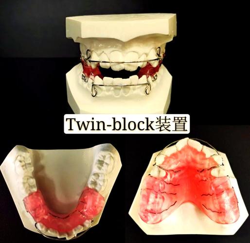 牙齿矫正器怎么选?隐形、金属哪种效果更好又适合自己?-图1 牙齿矫正器怎么选?隐形、金属哪种效果更好又适合自己?-图1