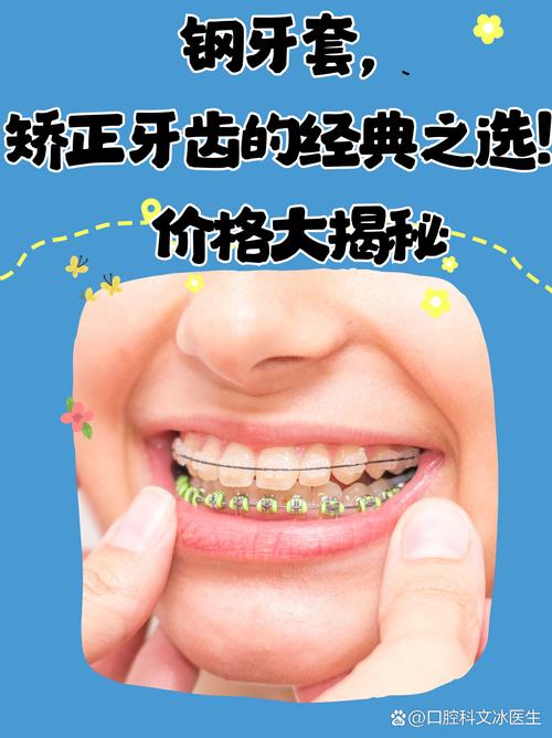 金属托槽矫正疼不疼?效果多久能显现?-图1 金属托槽矫正疼不疼?效果多久能显现?-图1