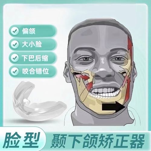 颞颌关节牙齿矫正-图3