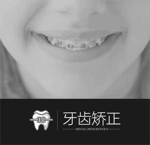 西安牙齿矫正去哪里靠谱?-图2 西安牙齿矫正去哪里靠谱?-图2