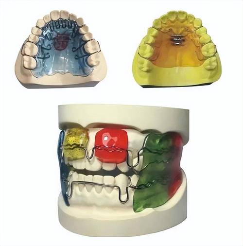 功能性牙齿矫正器,与传统矫正有何不同?-图3 功能性牙齿矫正器,与传统矫正有何不同?-图3