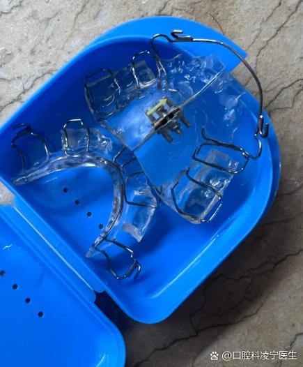 牙齿反合的矫正器-图1 牙齿反合的矫正器-图1