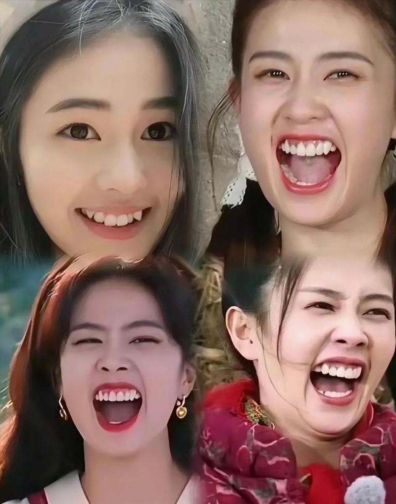 明星拔牙矫正牙齿-图2 明星拔牙矫正牙齿-图2