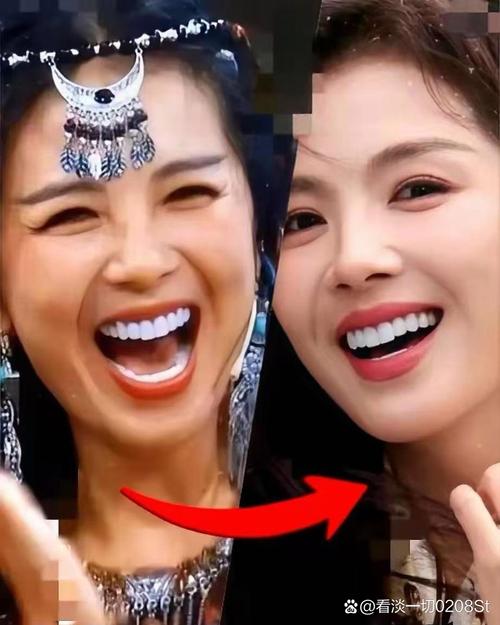 明星拔牙矫正牙齿-图3 明星拔牙矫正牙齿-图3