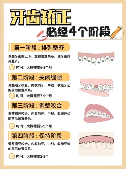 牙齿往里矫正有哪些有效方法？-图1