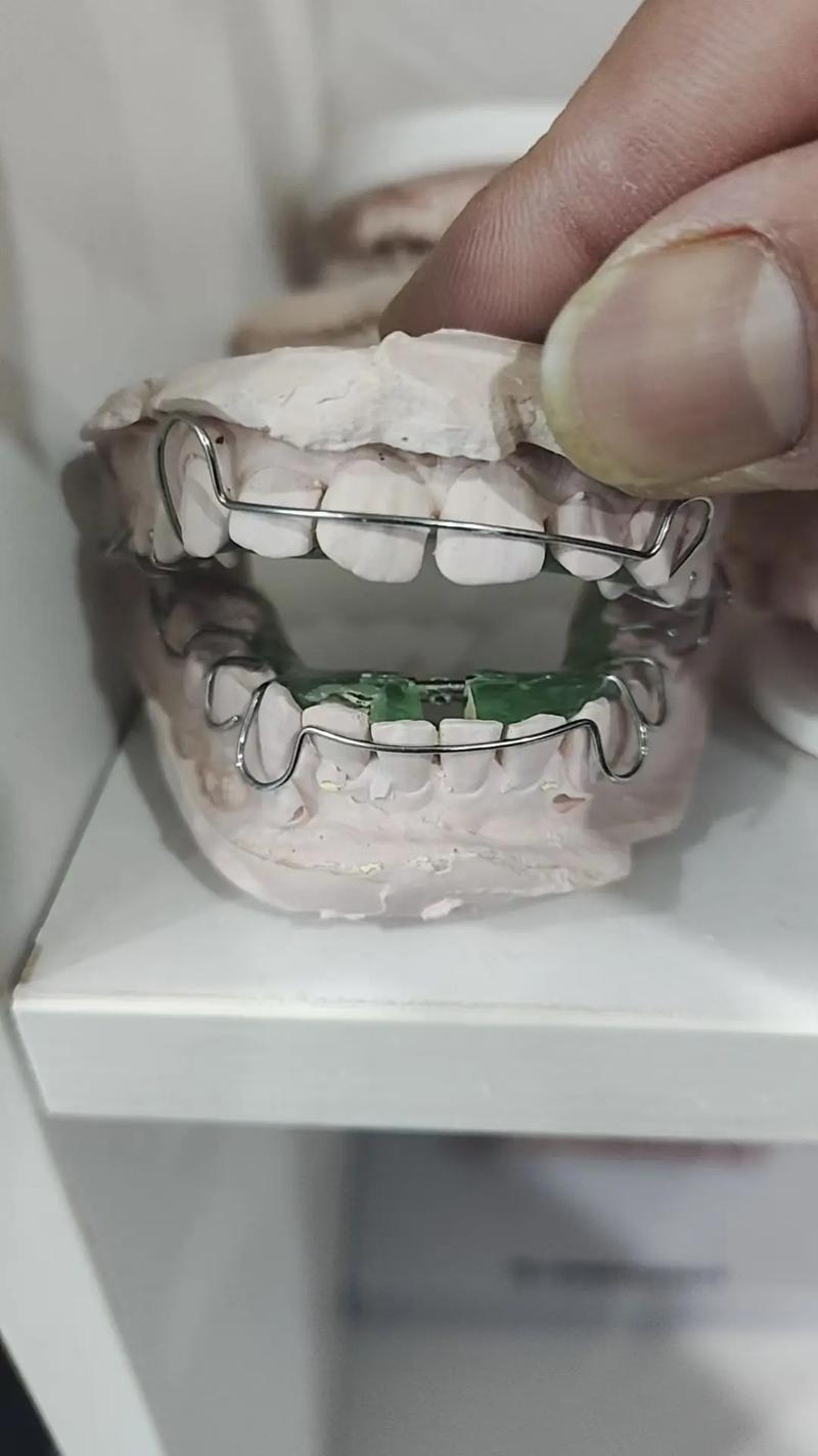 口腔诊所牙齿矫正-图3