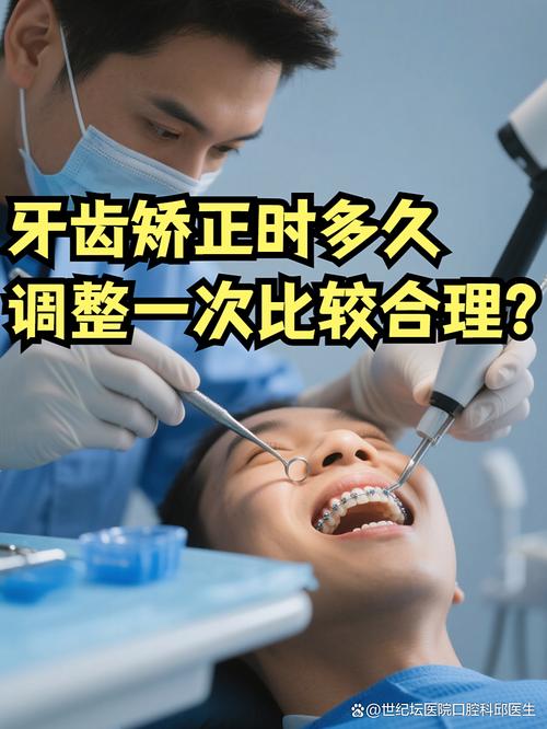 牙齿矫正一般多久需要复诊一次?-图1 牙齿矫正一般多久需要复诊一次?-图1