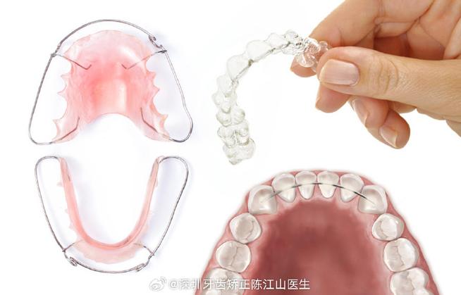 深圳哪里牙齿矫正-图3 深圳哪里牙齿矫正-图3