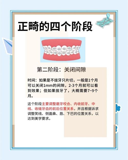 牙齿矫正为何需要较长时间？这些因素影响进度-图3
