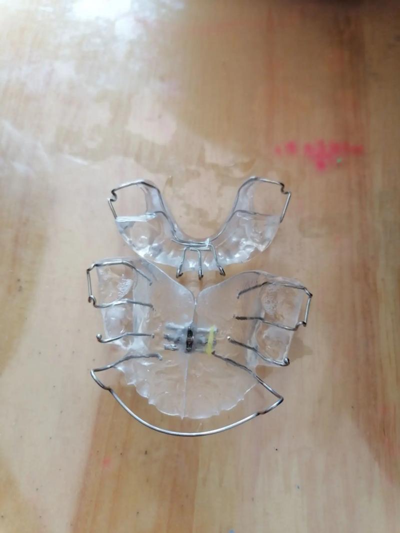 网上牙齿矫正器靠谱吗？安全效果能保证吗？-图2