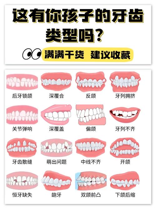牙齿矫正的好方法-图3