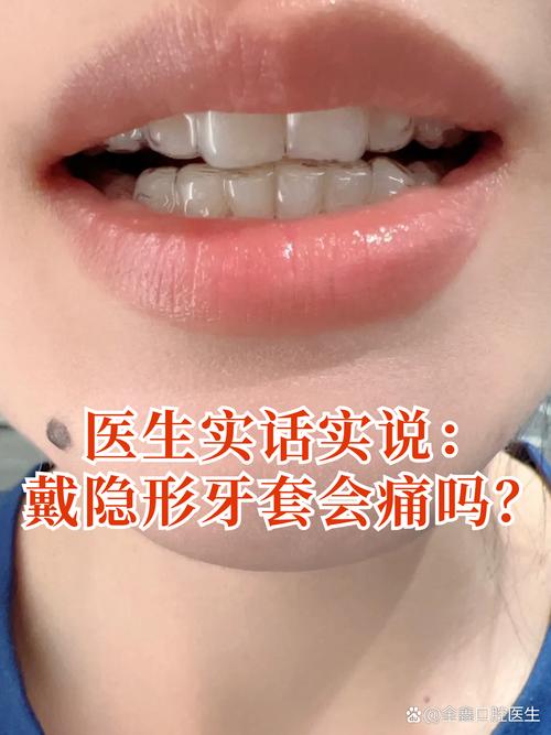 牙齿矫正会很疼吗？过程到底有多难受？-图1