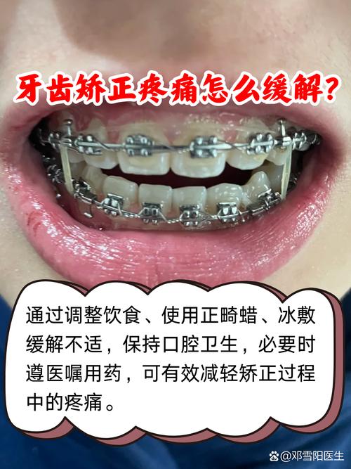 牙齿矫正会很疼吗？过程到底有多难受？-图2