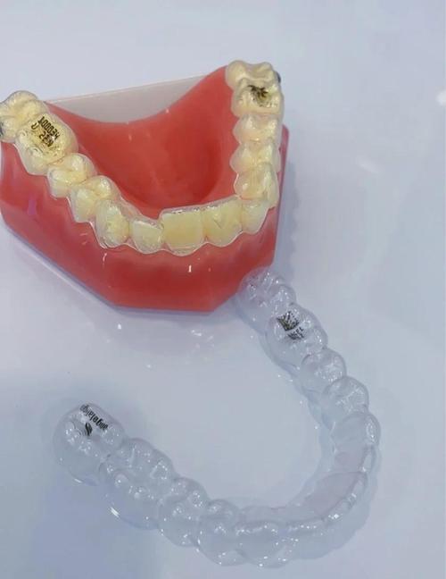 南京隐形矫正牙齿效果好不好？价格贵不贵呢？-图3