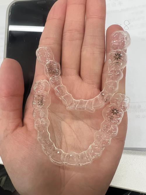 牙齿矫正隐形托槽-图1