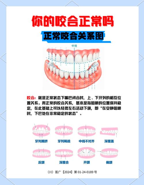 牙齿矫正怎么咬合-图1