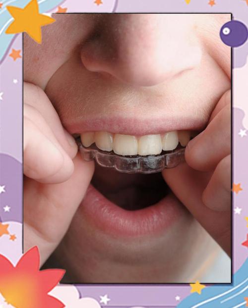 12岁是牙齿矫正的黄金时期吗?矫正效果如何?-图2 12岁是牙齿矫正的黄金时期吗?矫正效果如何?-图2