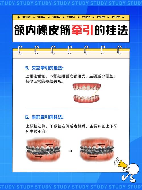 矫正牙齿的橡皮圈有何用？使用时要注意什么？-图1