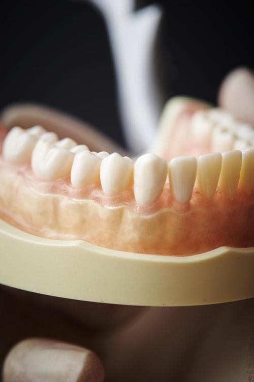 牙齿矫正与烤瓷牙能同时做吗？效果会如何？-图2