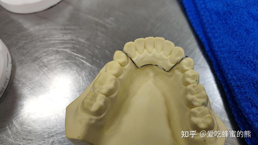 牙齿矫正弓丝弯制-图3 牙齿矫正弓丝弯制-图3