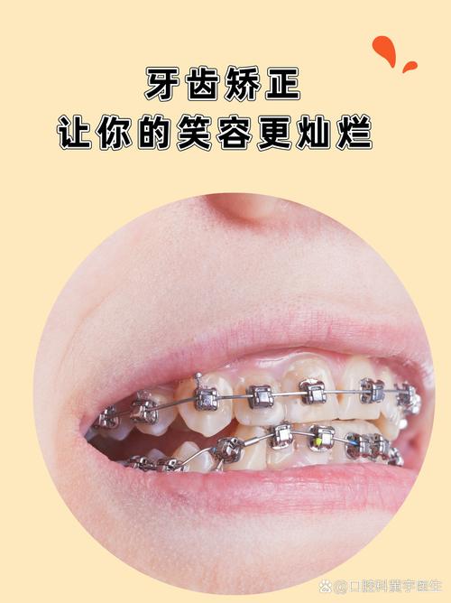 国外矫正牙齿贵吗-图2