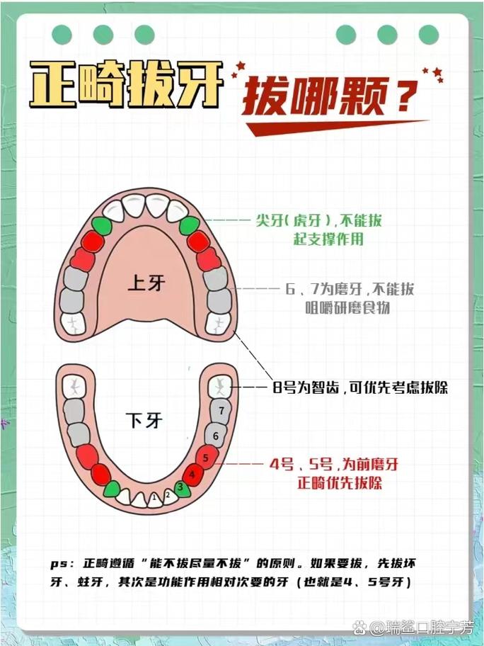 拔牙矫正牙齿的原理是什么？为何要通过拔牙矫正？-图2