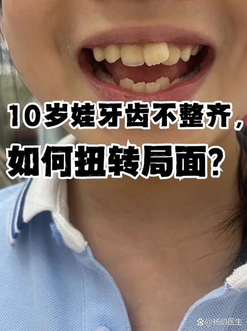父母不让矫正牙齿，是怕疼还是怕花钱？-图1
