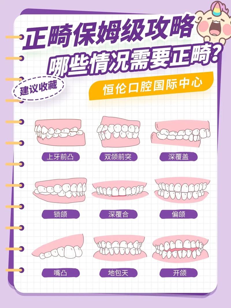 牙齿要不要矫正?关键看是否影响健康和美观!-图3 牙齿要不要矫正?关键看是否影响健康和美观!-图3