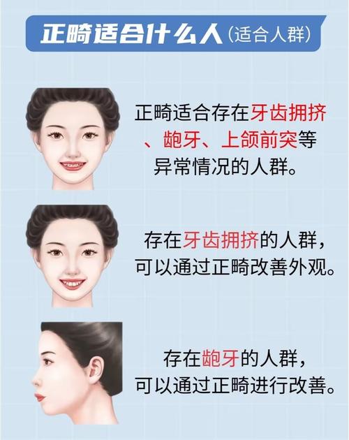 牙齿矫正年龄要求-图1 牙齿矫正年龄要求-图1