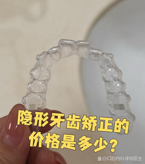 南京牙齿隐形矫正效果如何？适合哪些人？-图1