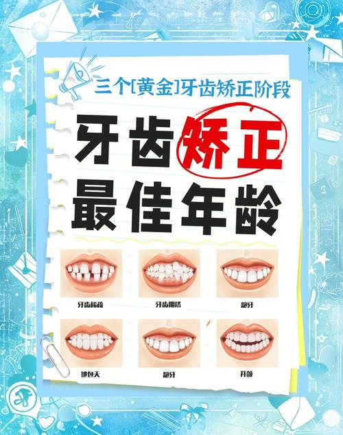 儿童牙齿矫正,黄金矫正期是几岁?家长必看关键时间点!-图1 儿童牙齿矫正,黄金矫正期是几岁?家长必看关键时间点!-图1