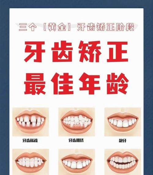 牙齿矫正适合年龄-图1