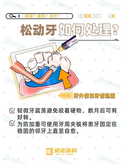 牙齿矫正真的会让牙齿松动吗？矫正期间和矫正后会怎样？-图2