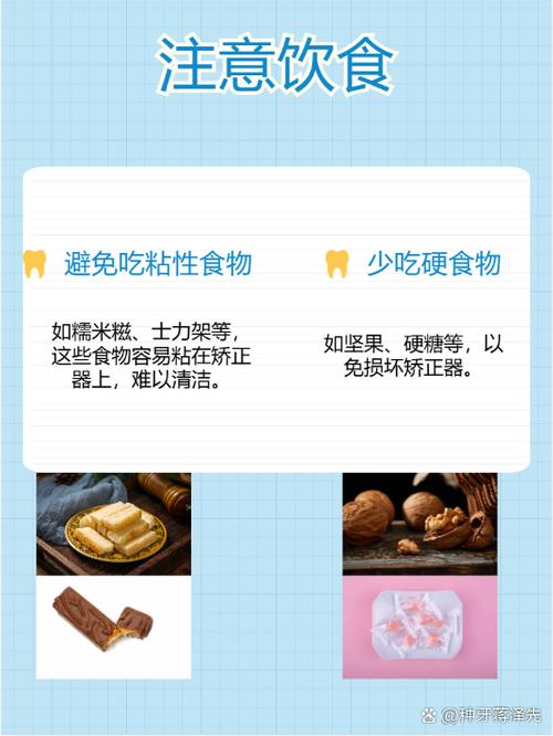 牙齿矫正一般多久-图1