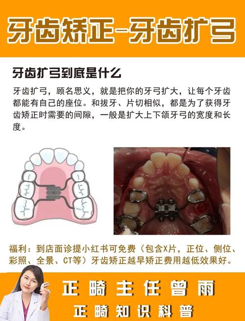 矫正牙齿时,专业话术对缓解焦虑、提升配合度和效果有何作用?-图1 矫正牙齿时,专业话术对缓解焦虑、提升配合度和效果有何作用?-图1