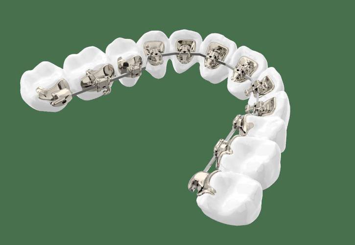 舌头和牙齿矫正-图2