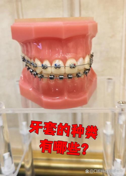 牙齿早期矫正套适合哪些孩子?矫正效果如何?-图3 牙齿早期矫正套适合哪些孩子?矫正效果如何?-图3