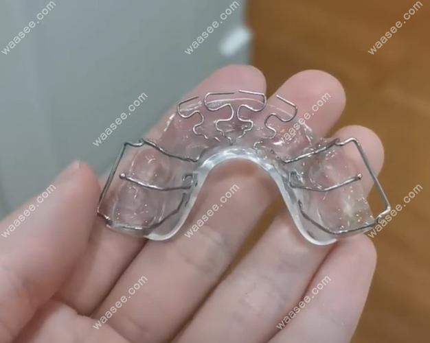 门牙v牙齿矫正-图3