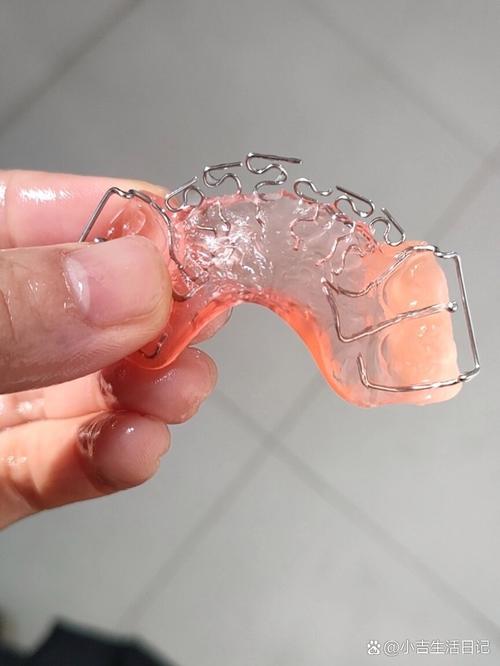 牙齿矫正拆钢丝时，疼吗？后续要注意什么？-图3