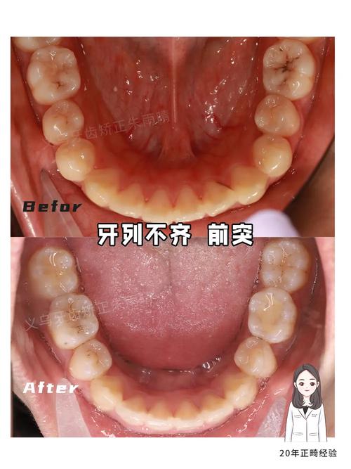 矫正牙齿没位置-图2