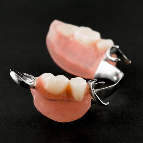 牙齿矫正有假牙-图3 牙齿矫正有假牙-图3