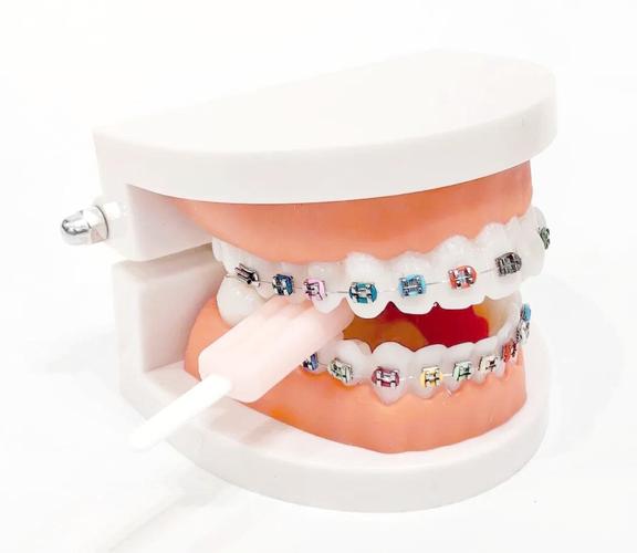 牙齿矫正贴合器-图3