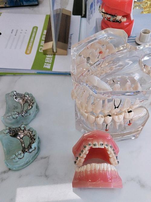 矫正牙齿材料图里有哪些材料？如何选择合适的？-图1