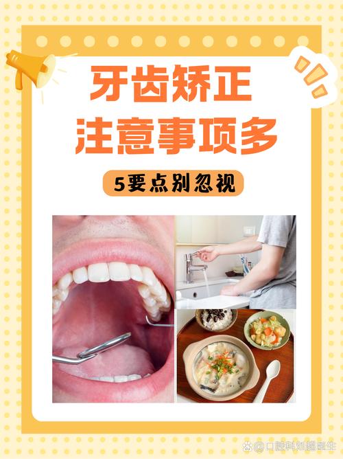 矫正牙齿卫生吗？清洁隐患需警惕！-图2