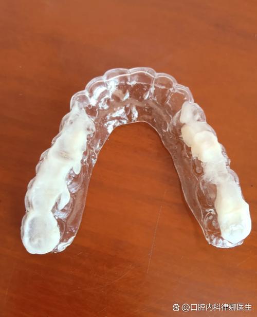 牙齿矫正旋转片如何帮助牙齿旋转矫正？-图3