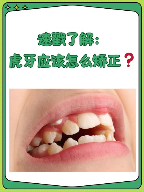 矫正牙齿拔虎牙，真的有必要这样做吗？-图1